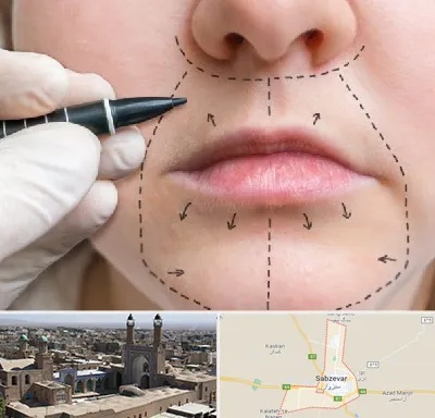 عمل سانترال لب در سبزوار