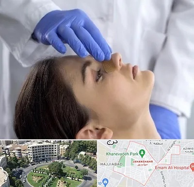 عمل بینی عروسکی در جهانشهر کرج 