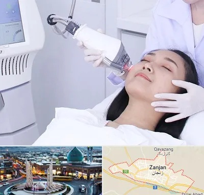 وایتنینگ در زنجان