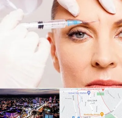 مزوژل در گلسار رشت 