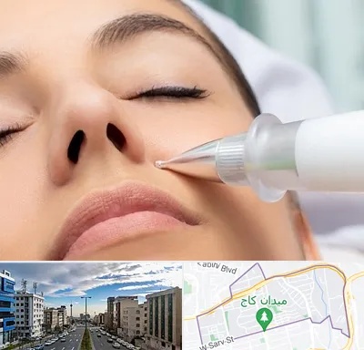 پلاسما جت بینی در سعادت آباد 