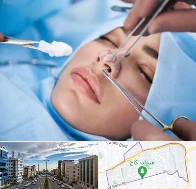 عمل ترمیمی بینی در سعادت آباد 