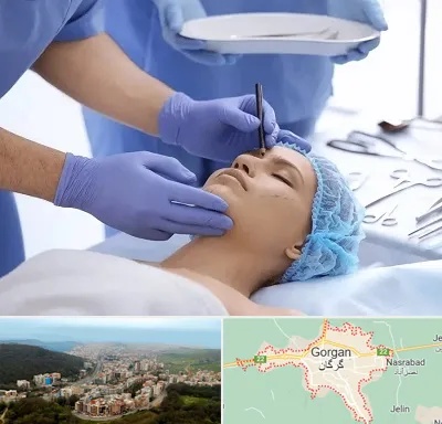 عمل بینی طبیعی در گرگان