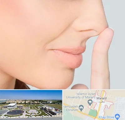 عمل تیپ پلاستی بینی در ملارد