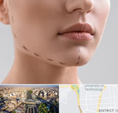 عمل زاویه فک در استاد معین 