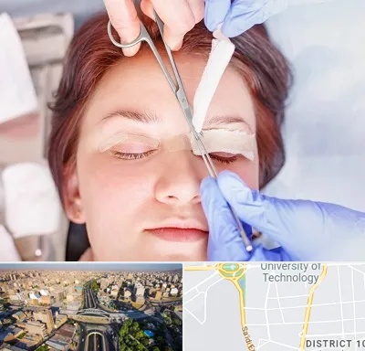 جراحی پلک افتاده در استاد معین 