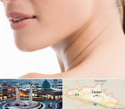 جراحی فک با لیزر در زنجان