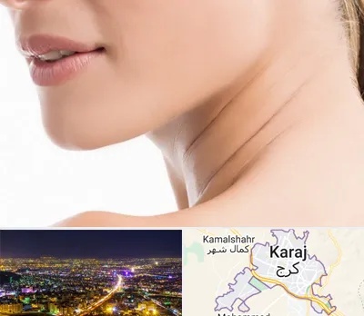 جراحی فک با لیزر در کرج