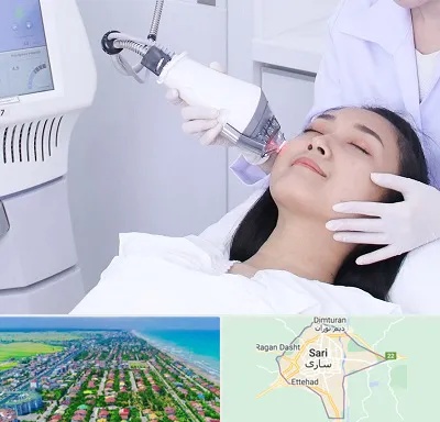 وایتنینگ در ساری