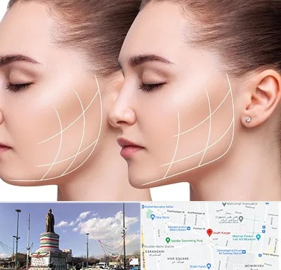 جراحی بوکال فت در کارگر جنوبی 