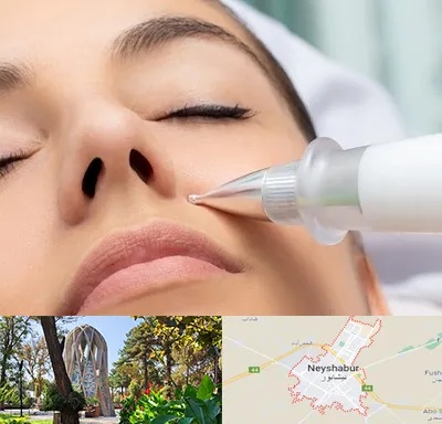 پلاسما جت بینی در نیشابور
