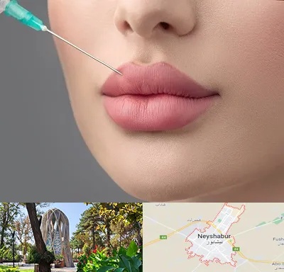 کلینیک ژل لب روسی در نیشابور