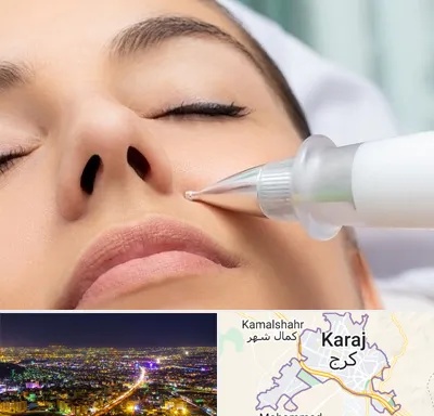 پلاسما جت بینی در کرج