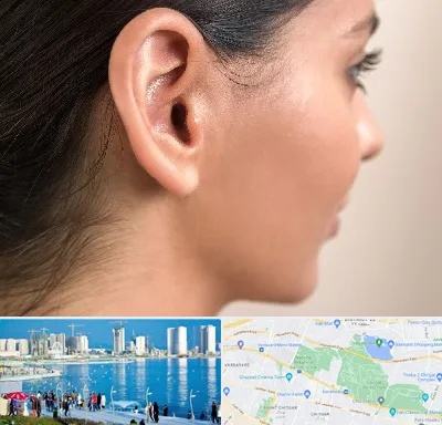 عمل گوش بل در چیتگر 