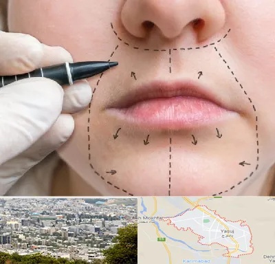 عمل سانترال لب در یاسوج