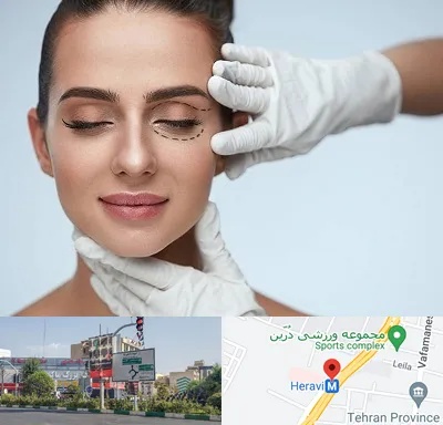 عمل پف چشم در هروی 