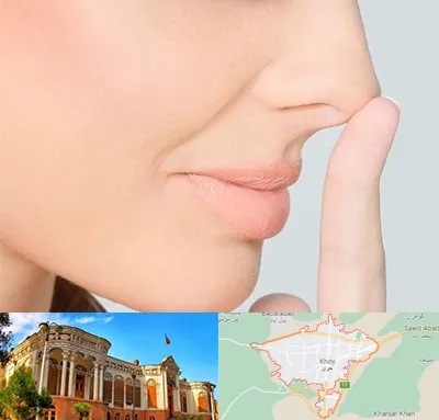 عمل تیپ پلاستی بینی در خوی