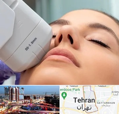 هایفوتراپی در صادقیه 