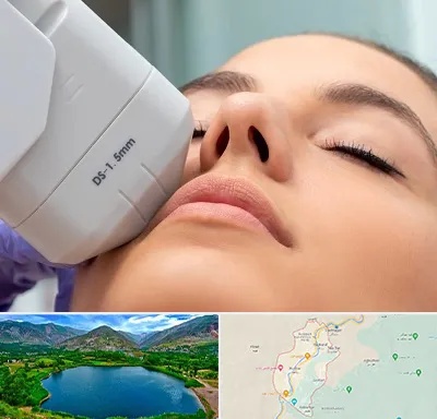 هایفوتراپی در رودبار