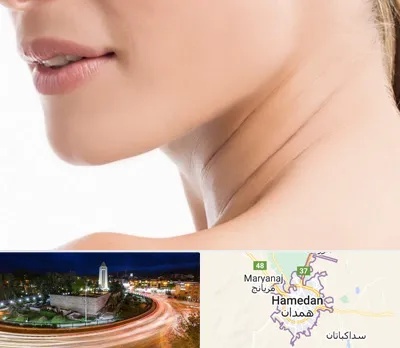 جراحی فک با لیزر در همدان