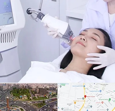 وایتنینگ در سبلان 