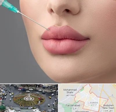 کلینیک ژل لب روسی در فردیس کرج 