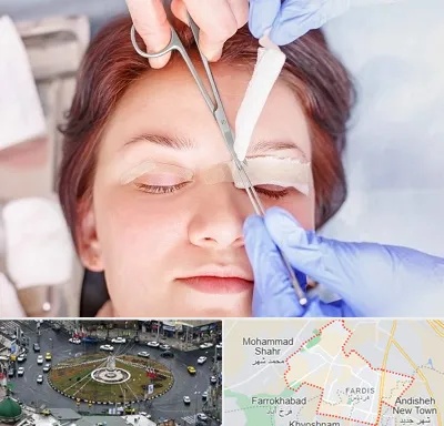 جراحی پلک افتاده در فردیس کرج 