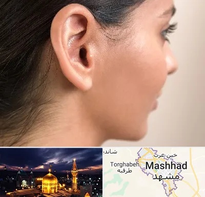 عمل گوش بل در مشهد