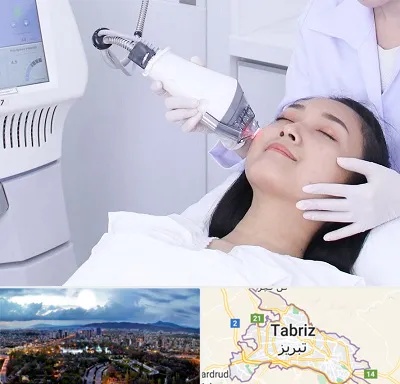 وایتنینگ در تبریز