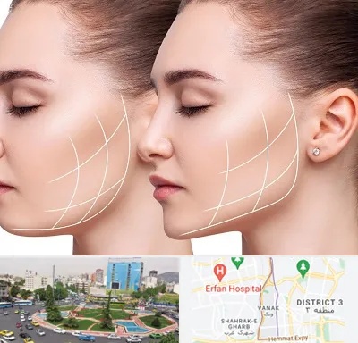 جراحی بوکال فت در ونک 