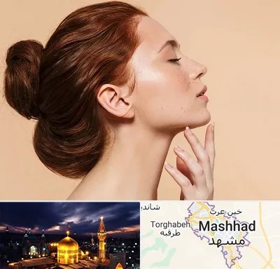 جراحی غبغب در مشهد