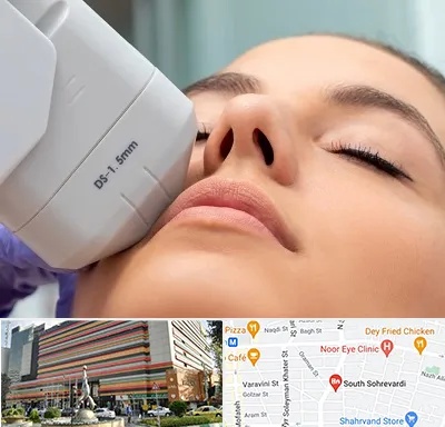 هایفوتراپی در سهروردی 