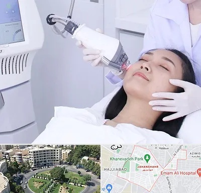 وایتنینگ در جهانشهر کرج 