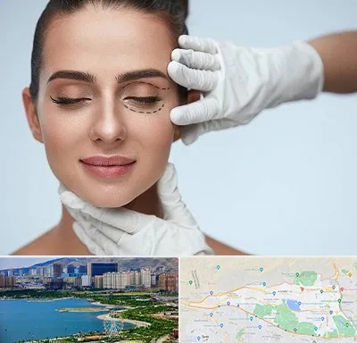 عمل پف چشم در منطقه 22 تهران 