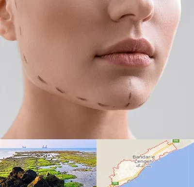 عمل زاویه فک در بندرلنگه