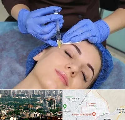 تزریق پروفایلو در عظیمیه کرج 