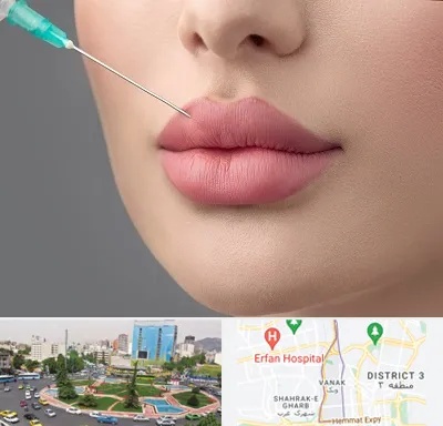 کلینیک ژل لب روسی در ونک 