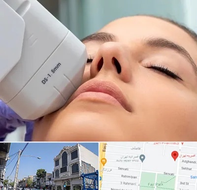 هایفوتراپی در افسریه 