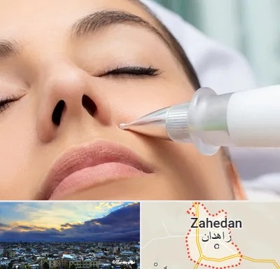 پلاسما جت بینی در زاهدان