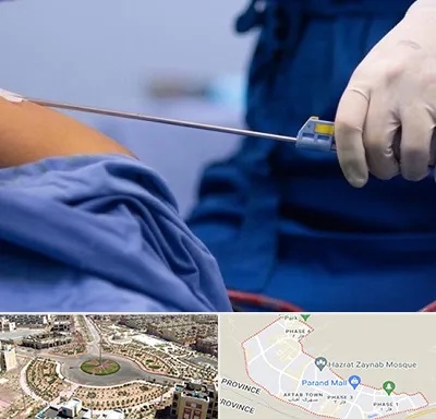 پیکر تراشی در پرند