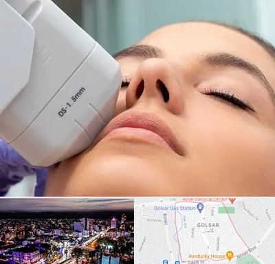 هایفوتراپی در گلسار رشت 