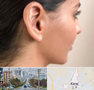 عمل گوش بل در گوهردشت کرج 