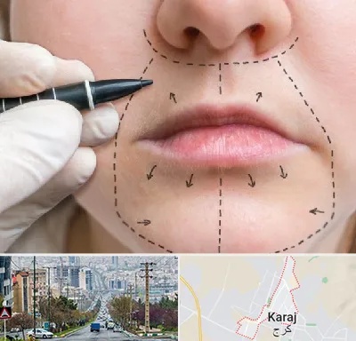 عمل سانترال لب در گوهردشت کرج 