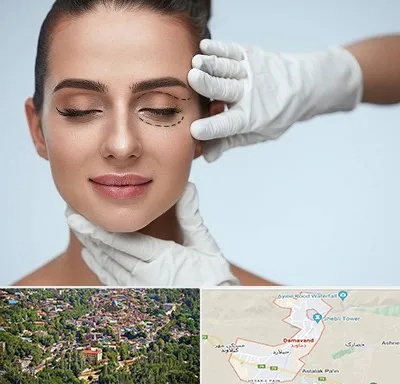 عمل پف چشم در دماوند