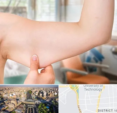براکیوپلاستی در استاد معین 