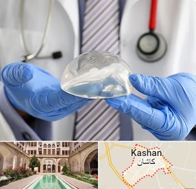 ماموپلاستی در کاشان
