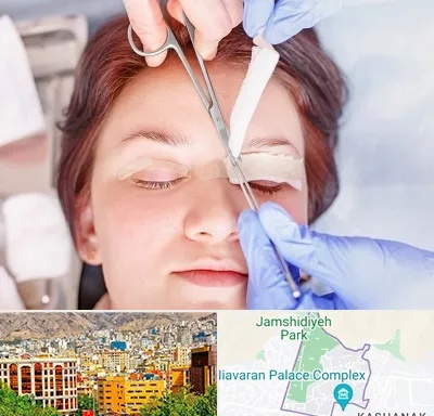 جراحی پلک افتاده در نیاوران 