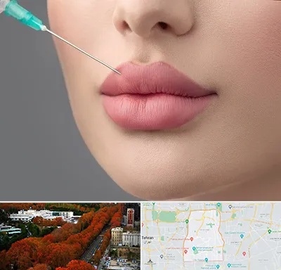کلینیک ژل لب روسی در منطقه 6 تهران 