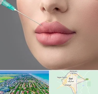 کلینیک ژل لب روسی در ساری