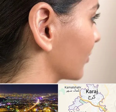 عمل گوش بل در کرج